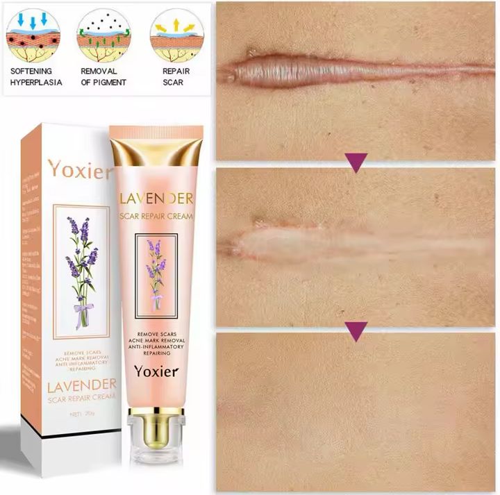 Yoxier Lavender Scar Repair Cream – Advanced Dark Spot & Scar Removal Treatment (20g)