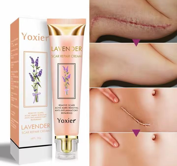 Yoxier Lavender Scar Repair Cream – Advanced Dark Spot & Scar Removal Treatment (20g)